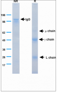 Figure_1._SDS-PAGE