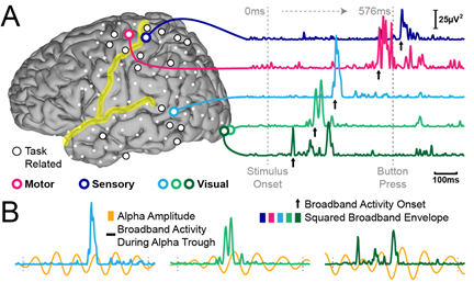 EEG brain function